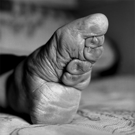 Tradition that hurts: Last traces of foot binding in China geotv.ge