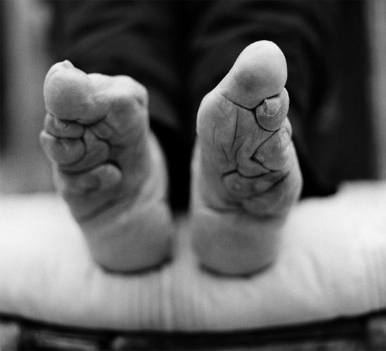 Tradition that hurts: Last traces of foot binding in China geotv.ge